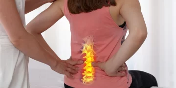 Is exercise an effective therapy to treat long-lasting low back pain?